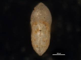 To NMNH Paleobiology Collection (Elphidium advenum margaritaceum cc10227 ap)