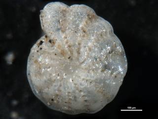 To NMNH Paleobiology Collection (Elphidium advenum depressulum cc15670)