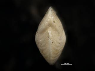 To NMNH Paleobiology Collection (Elphidium chapmani cc23547 ap)