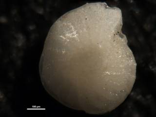 To NMNH Paleobiology Collection (Elphidium africanum cc58092)