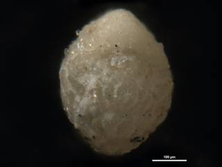 To NMNH Paleobiology Collection (Elphidium dominicense cc63632 ap)