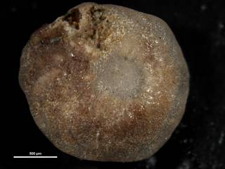 To NMNH Paleobiology Collection (Amphistegina canaensis cc63162 b)