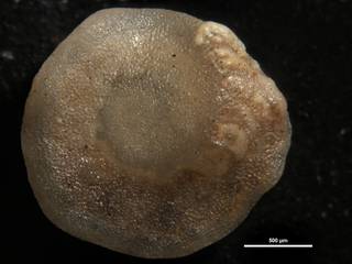 To NMNH Paleobiology Collection (Amphistegina canaensis cc63162)