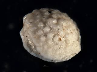 To NMNH Paleobiology Collection (Amphistegina alabamensis 559728)