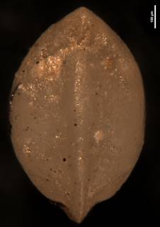 To NMNH Paleobiology Collection (Robulus abuillotensis CC 62396)