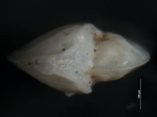 To NMNH Paleobiology Collection (Robulus chiranus CC 48866 ap)