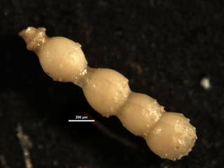 To NMNH Paleobiology Collection (Ellipsonodosaria nuttalli aculeata CC57461)