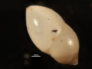 To NMNH Paleobiology Collection (Ellipsopolymorphina fornasini USNM472536)