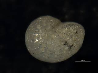 To NMNH Paleobiology Collection (Elphidium hyalocostatum USNM 624228)