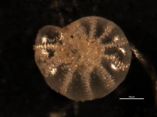 To NMNH Paleobiology Collection (Elphidium oceanicum CC 15673)