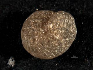 To NMNH Paleobiology Collection (Elphidium skyringense CC 64407)