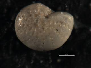 To NMNH Paleobiology Collection (Elphidium twiggsanum CC 42554)