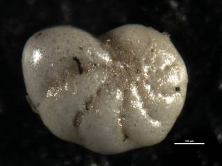 To NMNH Paleobiology Collection (Elphidium varium USNM 641133)