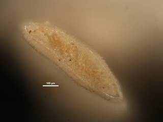 To NMNH Paleobiology Collection (Plectofrondicularia herrerae CC23936 ap)