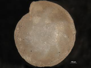 To NMNH Paleobiology Collection (Robulus abuillotensis CC 62396 main)