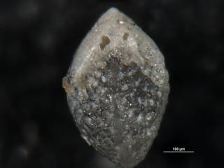 To NMNH Paleobiology Collection (Elphidium ingressans cc64152 ap)