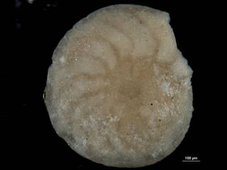 To NMNH Paleobiology Collection (Amphistegina bikiniensis 548215 view 2)