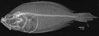To NMNH Extant Collection (Hippoglossina macrops USNM 41147 holotype radiograph)