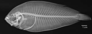 To NMNH Extant Collection (Paralichthodes algoensis USNM 261357radiograph)