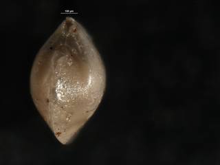 To NMNH Paleobiology Collection (Robulus inhabilis usnm 549079 ap)