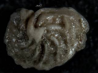 To NMNH Paleobiology Collection (Robulus jerseyanus USNM 547468)