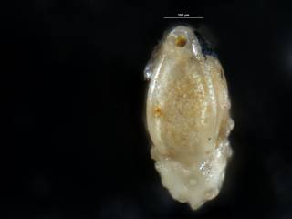 To NMNH Paleobiology Collection (Robulus jugosus USNM 371167 ap)