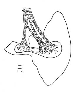 To NMNH Extant Collection (Ichthyococcus irregularis P19382 illustration)