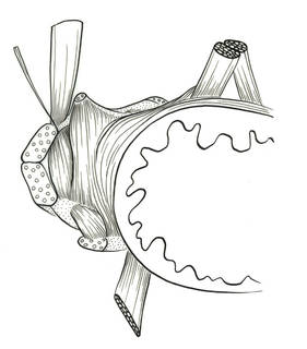 To NMNH Extant Collection (Rondeletia loricata P16464 illustration)