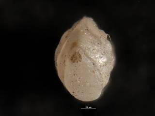 To NMNH Paleobiology Collection (Robulus mexicanus alticostatus CC 14183 para 5 of 5b)
