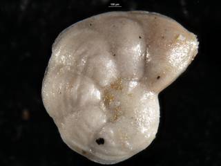 To NMNH Paleobiology Collection (Robulus nuttalli obliquicostata CC35889 a)