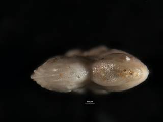To NMNH Paleobiology Collection (Robulus nuttalli obliquicostata CC 35889 b)