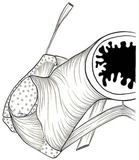 To NMNH Extant Collection (Alepocephalus tenebrosus P16409 illustration)