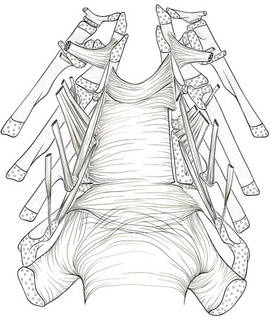 To NMNH Extant Collection (Alepocephalus tenebrosus P16410 illustration)