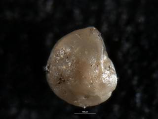 To NMNH Paleobiology Collection (Robulus pustulatus USNM 549085 holo a)