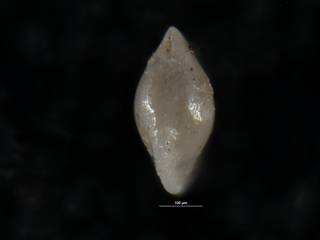 To NMNH Paleobiology Collection (Robulus roscidus USNM 549114 holo b)