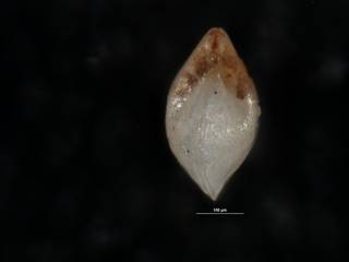 To NMNH Paleobiology Collection (Robulus ruinosus USNM 549017 holo b)