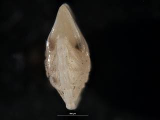 To NMNH Paleobiology Collection (Robulus spisso-costatus CC 24544 holo b)