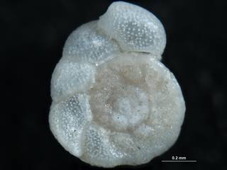 To NMNH Paleobiology Collection (Cibicides lobatulus 642403 plesio)