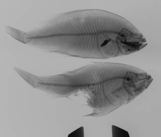 To NMNH Extant Collection (Citharichthys USNM 101896 radiograph)