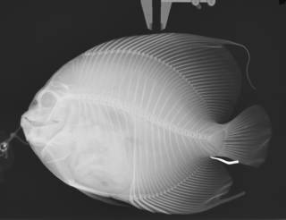 To NMNH Extant Collection (Pomacanthus arcuatus USNM 192379 radiograph)