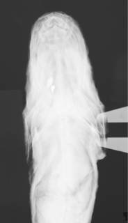To NMNH Extant Collection (Bassozetus compressus USNM 206917 radiograph head dorsal)