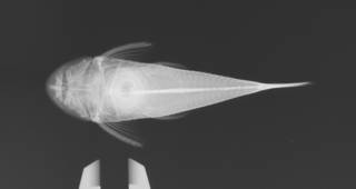 To NMNH Extant Collection (Chaetostoma USNM 284544 radiograph dorsal)