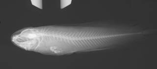 To NMNH Extant Collection (Dinematichthys iluocoeteoides USNM 366842 radiograph)
