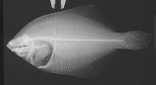 To NMNH Extant Collection (Pleuronectes americanus USNM 395010 radiograph)