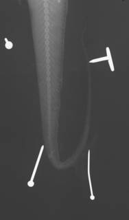 To NMNH Extant Collection (Hymenocephalus lethonemus USNM 50936 type radiograph caudal)
