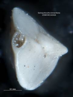 To NMNH Paleobiology Collection (Quinqueloculina lamarckiana 643426 ap)
