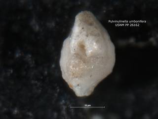 To NMNH Paleobiology Collection (Pulvinulinella umbonifera PP26162 holo 3)