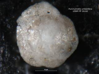 To NMNH Paleobiology Collection (Pulvinulinella umbonifera PP26162 holo 1)