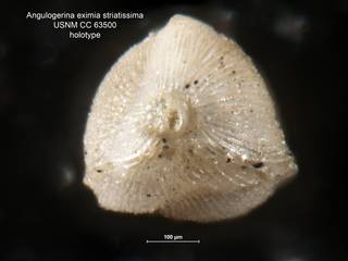 To NMNH Paleobiology Collection (Angulogerina eximia striatissima CC63500 ap)