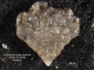 To NMNH Paleobiology Collection (Ventilabrella eggeri var. glabrata CC24406 holo 1)